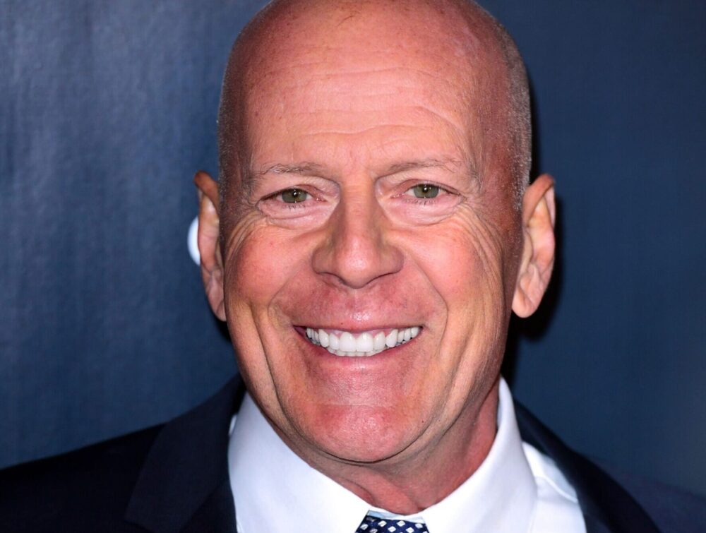 What is frontotemporal dementia? Bruce Willis’s condition explained