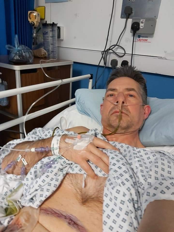 Adam Eshborn, aged 48, EUROPAC participant after full pancreatectomy.