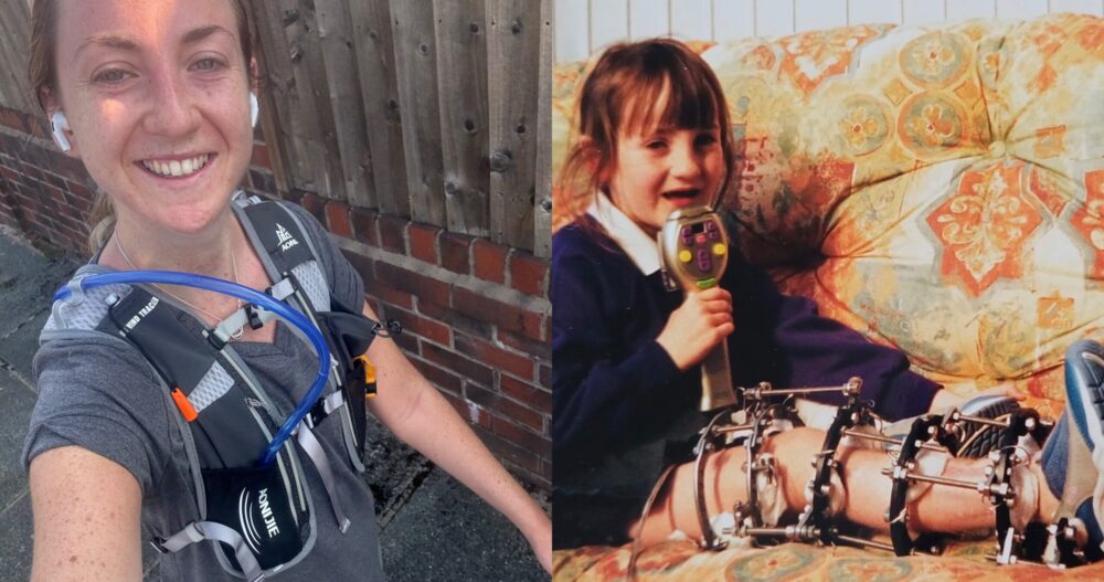 Wirral woman who had to learn to walk again 10 times is running half marathon for Alder Hey