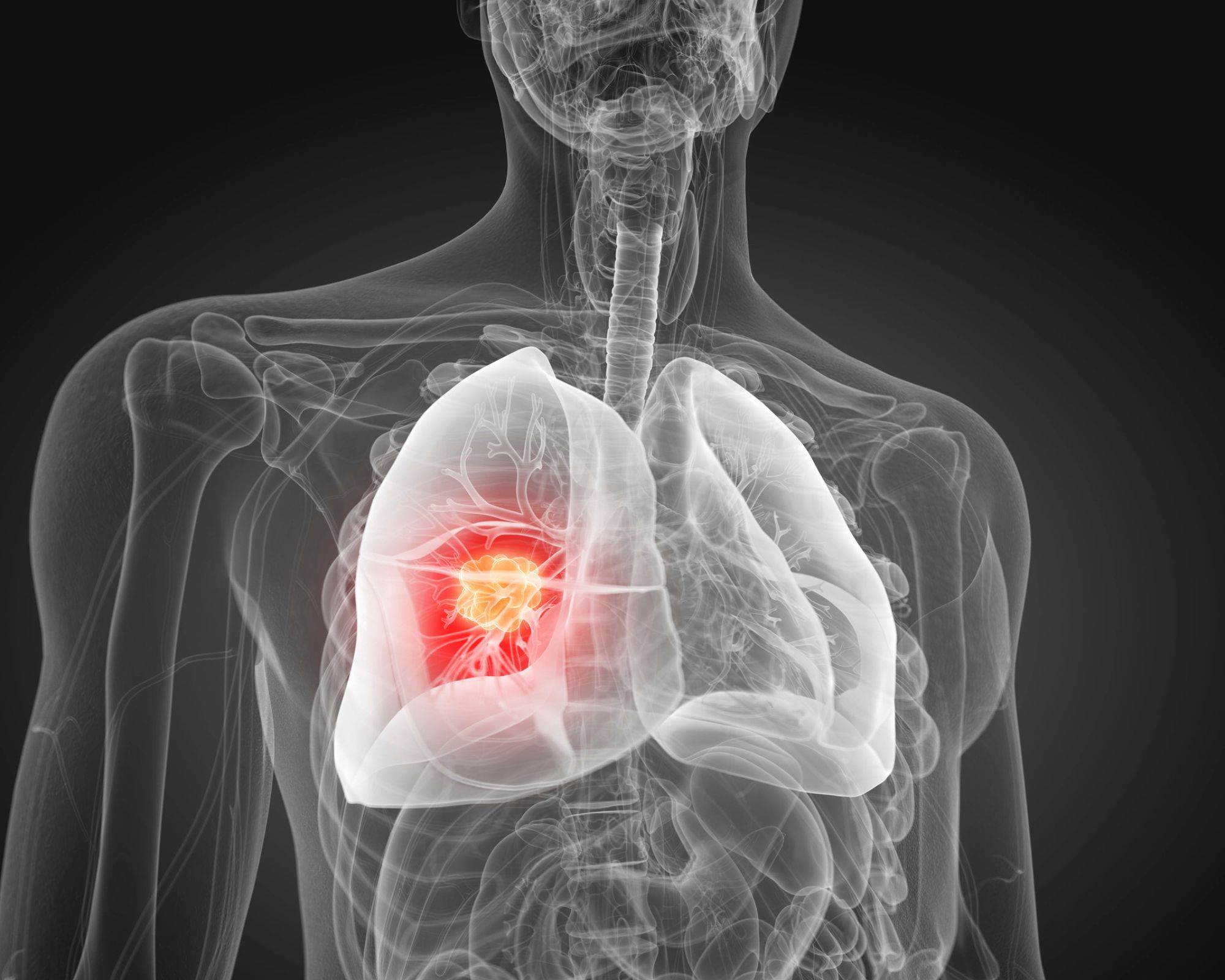 Clatterbridge cancer centre