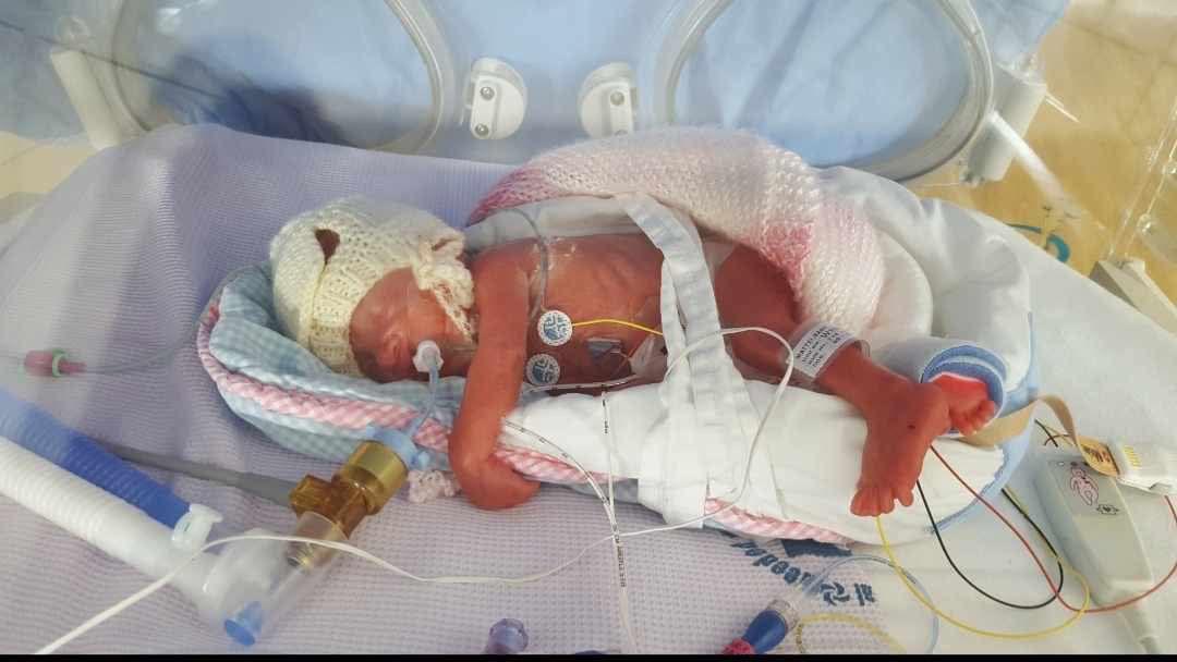 Miracle Babies
